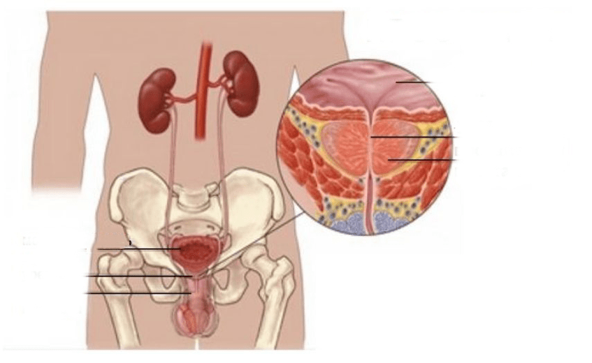 prostatīts vīriešiem